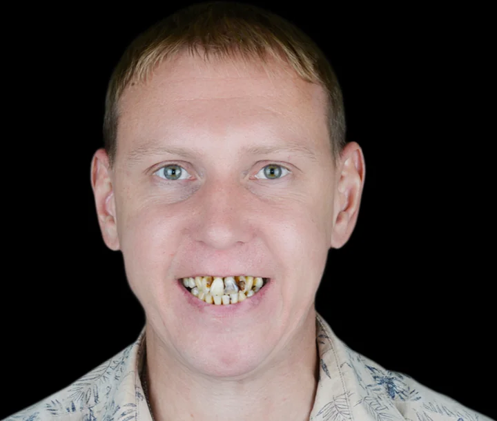 До